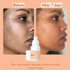 WishCare Super Bright C16 Vitamin C Serum 30Ml For Oily Dry Combination Skin Brightening Dark Spots