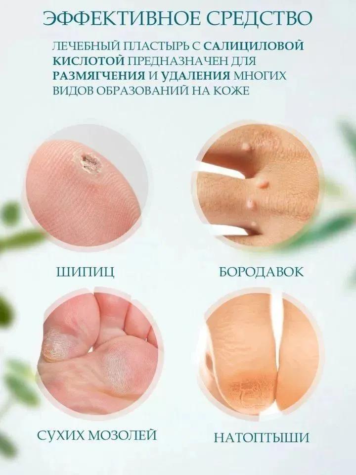 Callus and corn plaster for feet, for core calluses