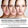 Ouhoe Dark Spot Repair Facial Serum - Softens Keratin, Repairs Dull Skin, Reduces Dark Spots, Brightens Skin