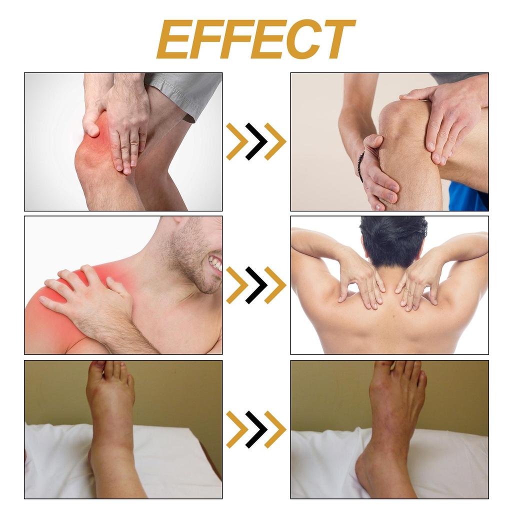 XIMONTH Gelenkschmerz-Linderungsspray Lindert Rücken-, Nacken-, Schulter-, Knieschmerzen Massage Gelenkmuskelschmerzen und Beschwerden