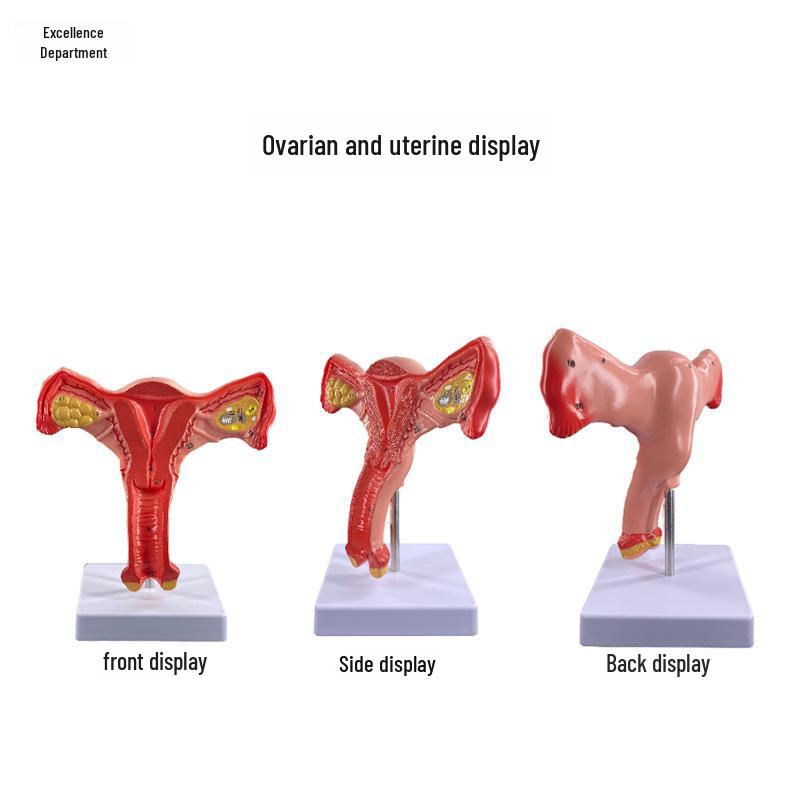 Fortschrittliches pathologisches Gebärmuttermodell einer Frau für gynäkologische Studien, anatomische Simulation der Fortpflanzungs-/Eierstockstruktur.