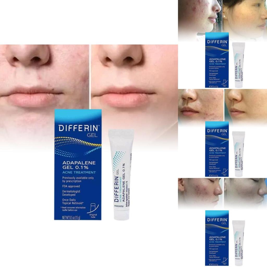 Differin Acne Treatment Gel Retinoid Gel For Clear Radiant Skin 15g