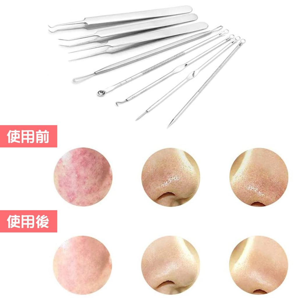 Coollooda Blackhead Remover and Tweezers of with Dedicated Pore Care Kit for Blackhead Acne Blackhead Acne Pore Nose Stainless Storage Case Silver