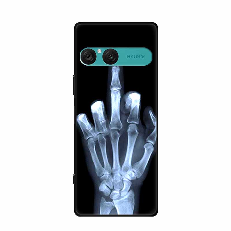 For Sony Xperia 10 VII Case Silicone Planet Cool Animal TPU Soft Back Cover for Sony Xperia10 VII Phone Cases XQ-FE54 XQZ-CBFE