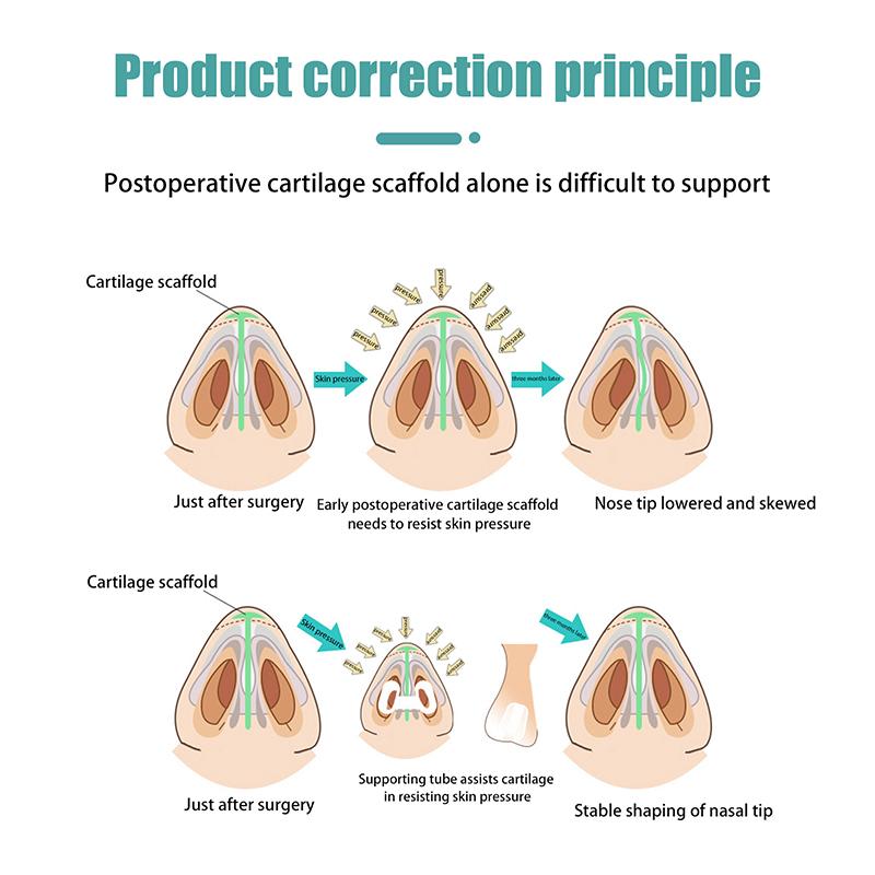 Postoperative Rhinoplasty Nostril Support Silicone Shaping Crooked Nose Correction Fixator Silica Gel Nose Clip Nasal Wing Beaut