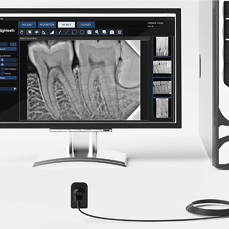 NanoPix Sensor With Software Friendly Use RVG Dental X-Ray Imaging System