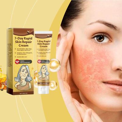 Crème de soin AMZ 30g crème éclaircissante pour les cicatrices d'acné, les taches brunes, les imperfections Soulage les rougeurs et les gonflements Hydrate et lisse la peau
