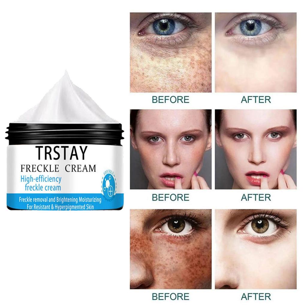 Spot Lightening and Translucent Cream, Moisturizing, Silky, Delicate, Mild and Non-irritating, Moisturizing the Skin and Improving Damaged Skin