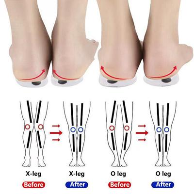 1 Pair Magnets Silicon Orthopedic Insoles Foot Care Tool For Men Women Health Care O/X Type Legs Knee Varus Correction Heel Pads
