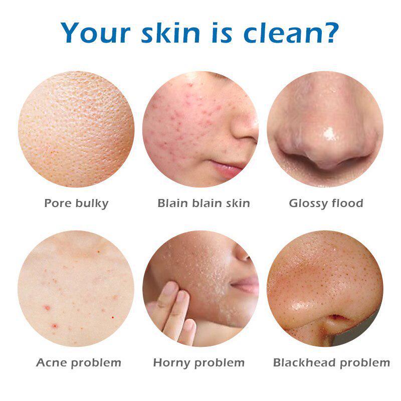 Mydło z soli morskiej Wybielanie Nawilżająca baza myjąca Usuwanie pryszczy Pory Leczenie trądziku Pielęgnacja twarzy Mydło Pod prysznic