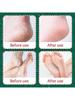 5 Pairs Christmas Foot Mask, Brightens Skin Tone, Moisturizes Feet, Softens Calluses, Soothes And Hy