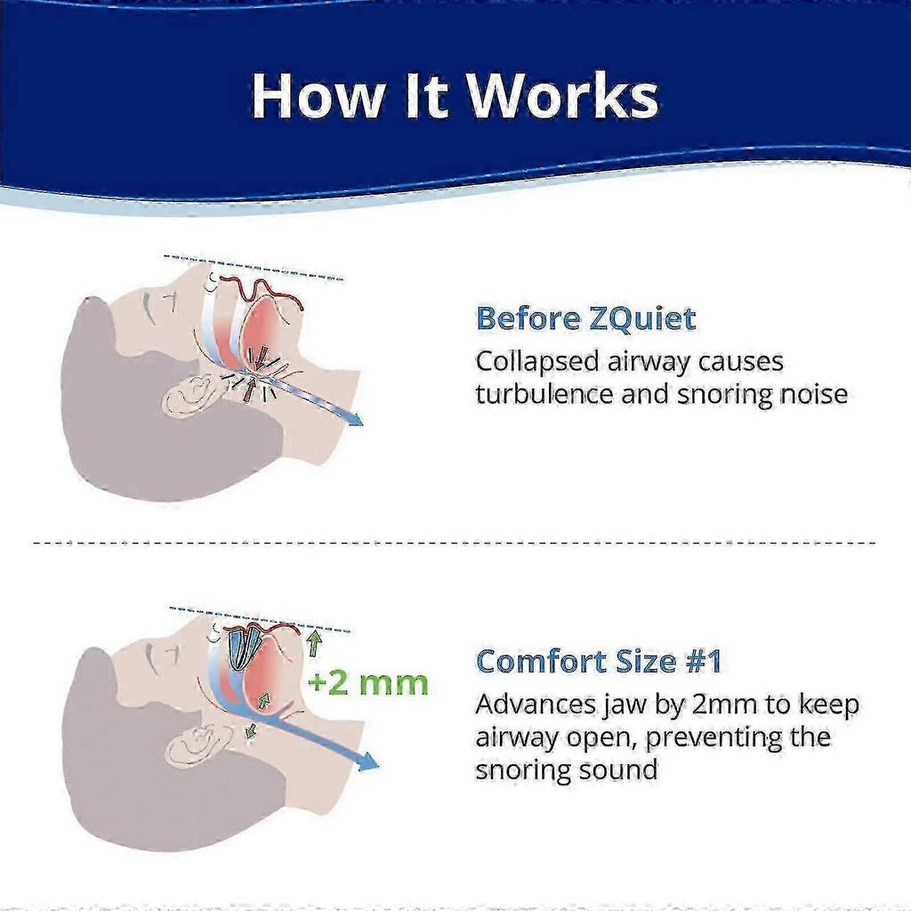 Anti-snoring Mouthpiece, Comfort Size 1, Single Refill, Blue, Bpa-free, Medical-grade Material