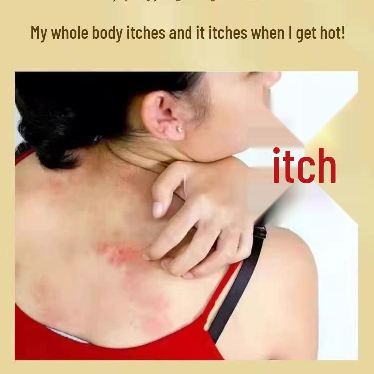 Yunnan Fungal King Skin Itch Relief Cream for Dry, Cracked Heels and Hard Skin Prevention