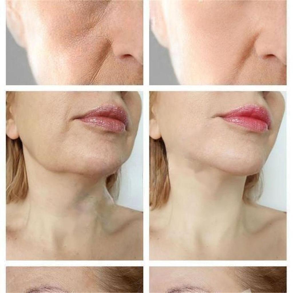 The anti-aging wrinkle moisturizing cream is gentle and non-irritating, smoothing wrinkles, lightening fine lines and leaving skin soft and refined