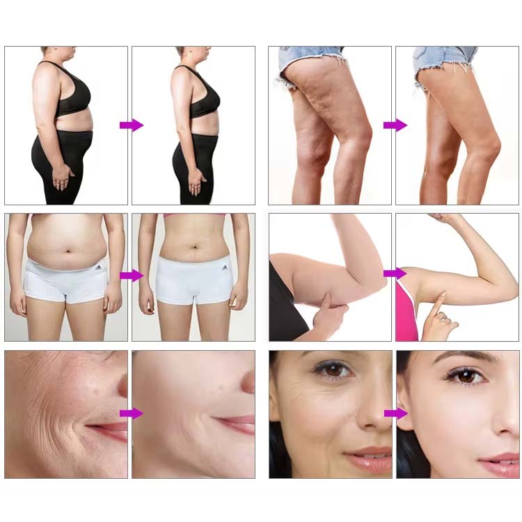 New 80K Five-in-one Fat Blasting Instrument Radio Frequency Negative Pressure Lifting And Shaping Fat Slimming Beauty Equipment