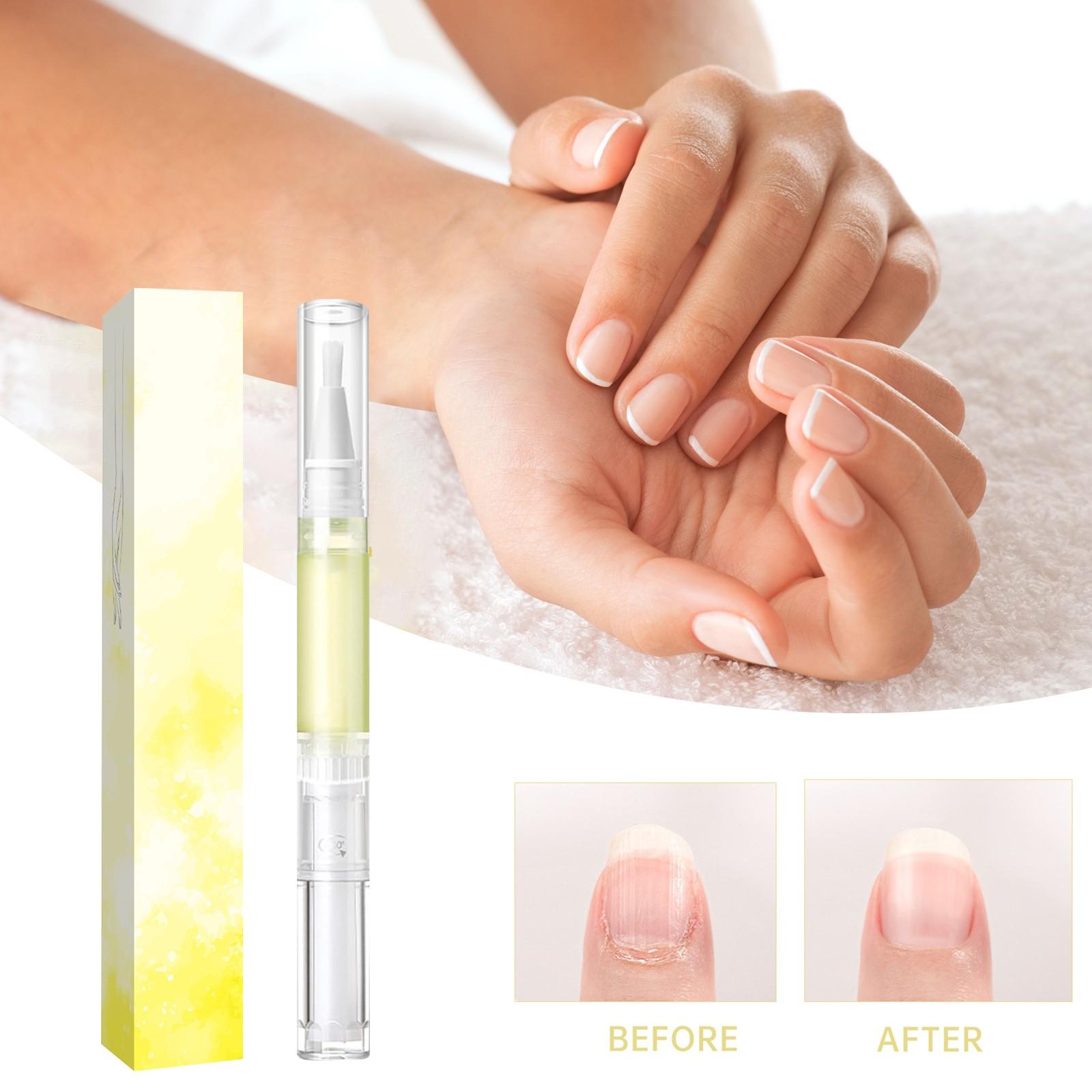 

2 мл и 3 мл Масло для роста ногтей, масло для омоложения ногтей Upgrade Rejuvenation, косметическое масло для роста ногтей Pen, масло для кутикулы для ногтей, средство для укрепления ногтей One Size