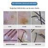 New 200X Hair Follicles Scalp Detector Wireless APP WIFI Digital Skin Analyzer Microscope Tool High Definition Skin Tester