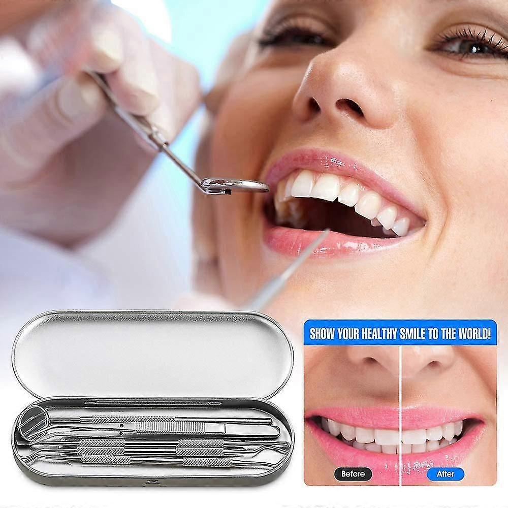 Dental Tools, 5 Pcs Professional Teeth Cleaning Tools Stainless Steel Stainless Steel Dental Scaler, Mouth Mirror, Tarter Scraper, Tooth Pi, Tweezer