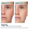 Kora Organics Turmeric Bha Pore   Brightening Treatment Mask 3.38 Oz 100 Ml