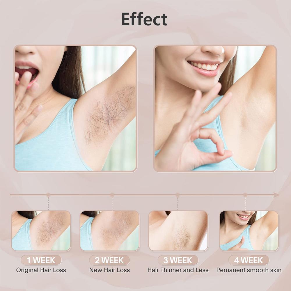 HOMZY Portable IPL Laser Epilator 999999 Flashes - Painless, Permanent Hair Removal for Women’s Body and Bikini Line