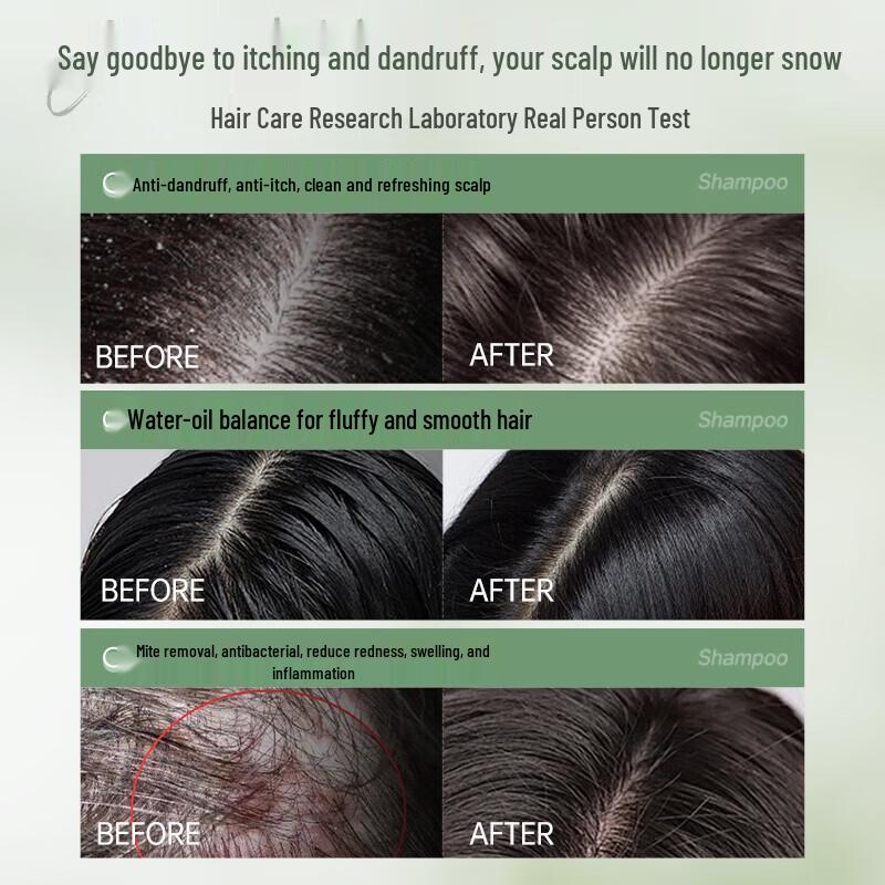 OHBT Selenium Sulfide Refreshing Cleansing Shampoo