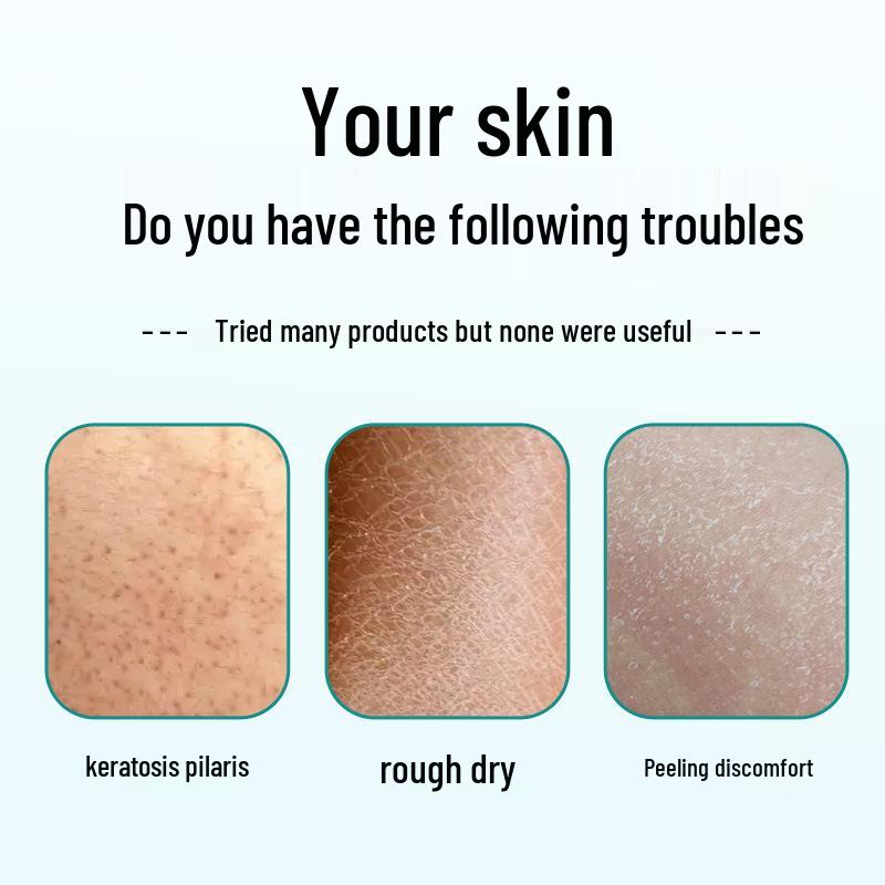 Keratosis Pilaris Repair Cream - Smooths Chicken Skin & Removes Follicle Bumps.