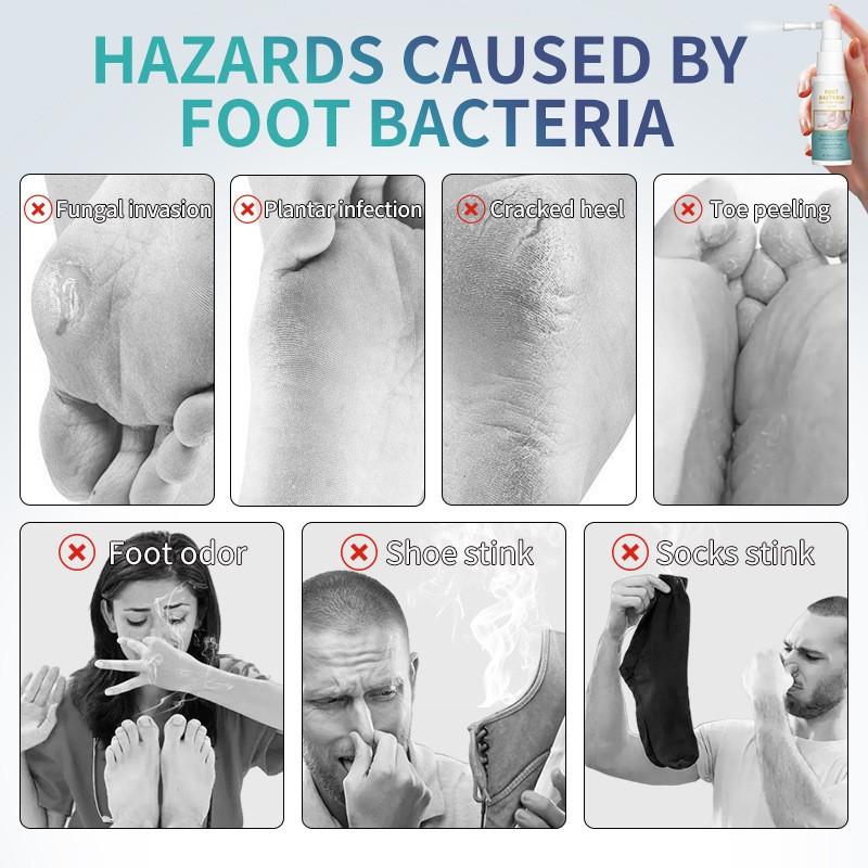 Schnell wirkende Fußpflege gegen Fußpilz, Natürliches Deodorant zur Pflege, Erfrischendes und desinfizierendes Spray für Frauen, 20 ml