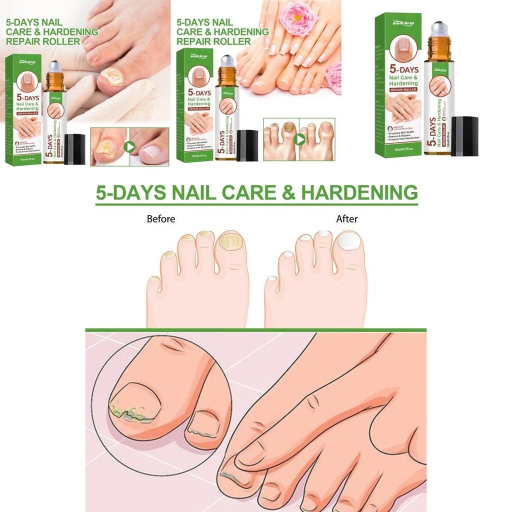 Fünf-Tage-Nagelreparatur-Roller zur Stärkung weicher und brüchiger Nägel mit pflegender Formel