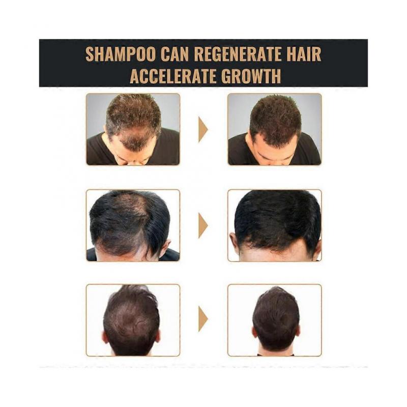 Spartan Shampoo Spartan Root Activator Shampoo Natürliche Haarwuchs Shampoos