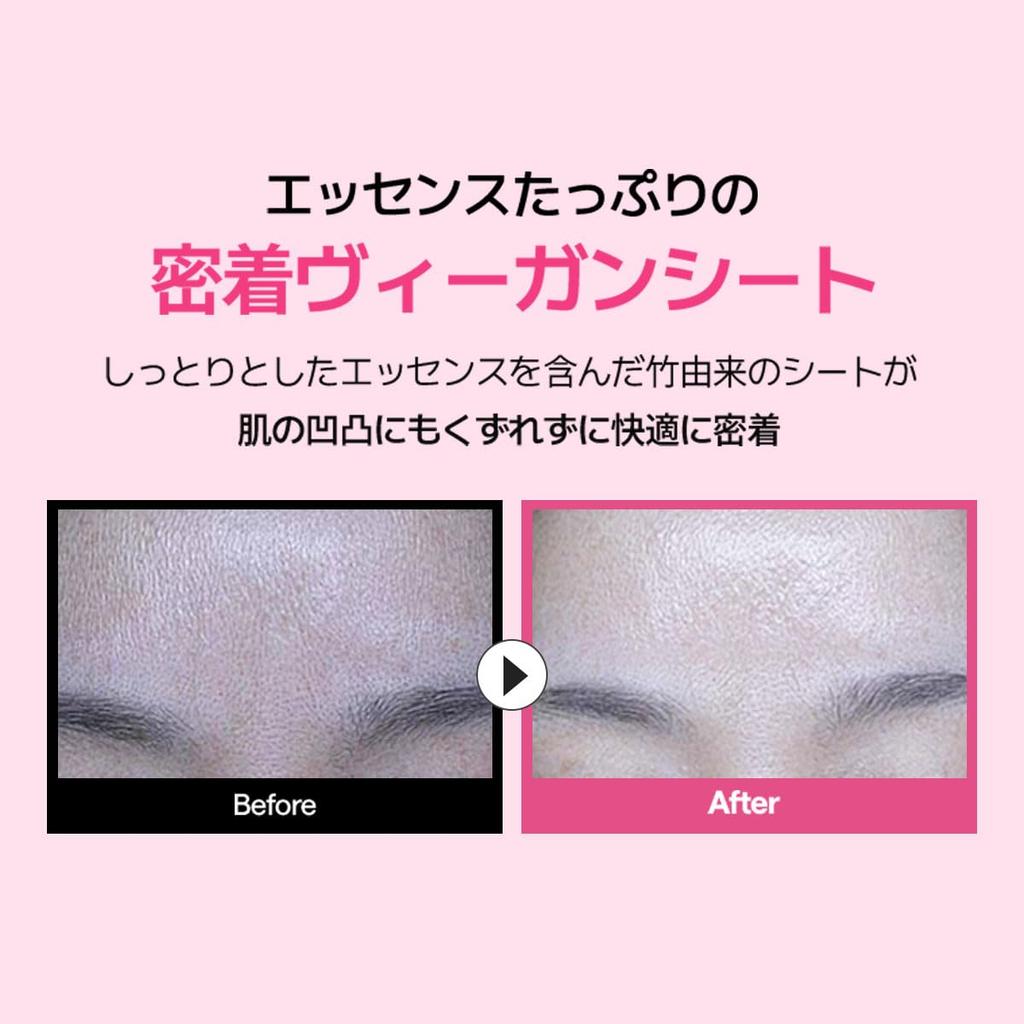 MEDIHEAL OFFICIAL Rose PDRN Essential Mask Pore Moisturizing Skin Care (10 Sheets) - Care, Serum-Rich,