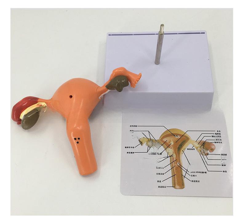 Large Female Reproductive Anatomy Model for Teaching and Family Planning