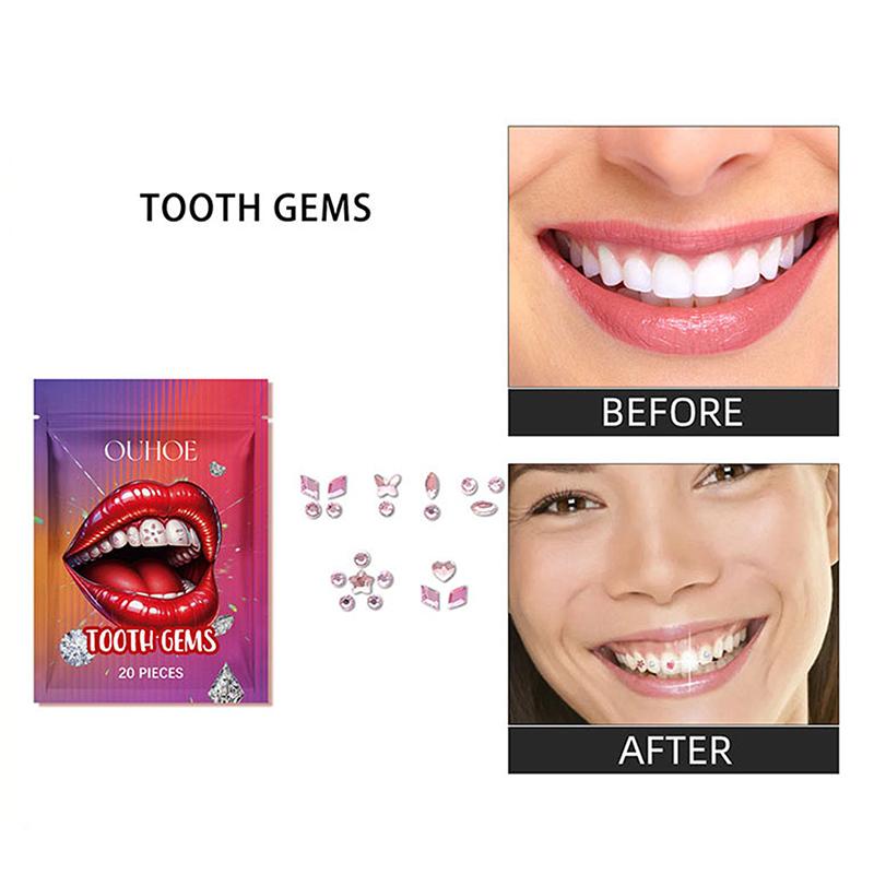 20Pcs Dental Rhinestones Tooth Rhinestones Teeth Jewelry Teeth Whitening Teeth Decoration Dental Crystal