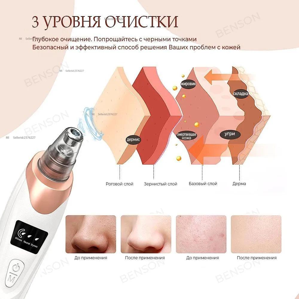 Vacuum washer tool to clear pores from black spots on the face. Cosmetic cleaner, using 5 kinds of fillers to clean face.