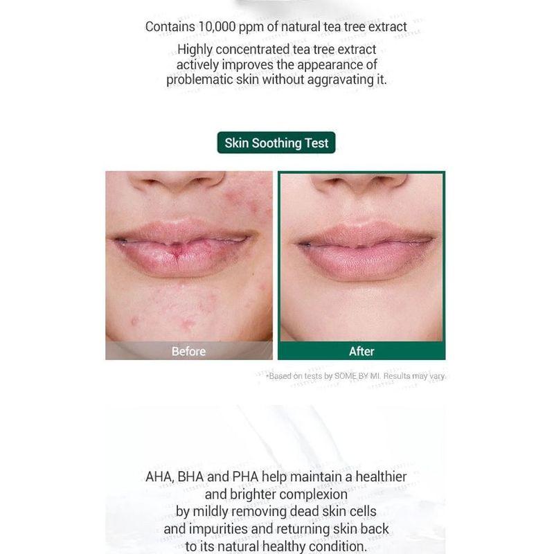 SOME BY MI AHA, BHA, PHA 30 Days Miracle Serum 50ml