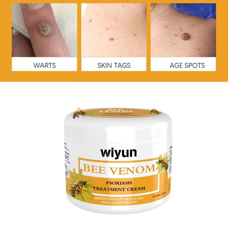 Premium Wiyun Bee Venom Skin Cream For Repairing Dry And Itchy Skin With Soothing Hydration
