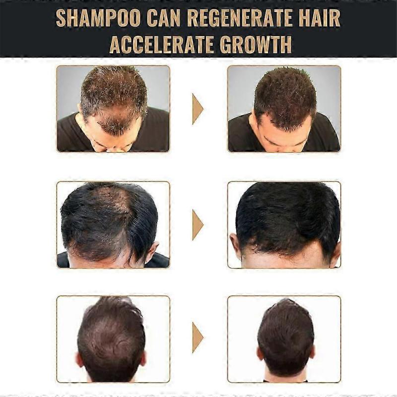 1/3/5x Spartan Shampoo, Spartan Wurzelaktivator Shampoo, Mane Wurzelaktivator Shampoo