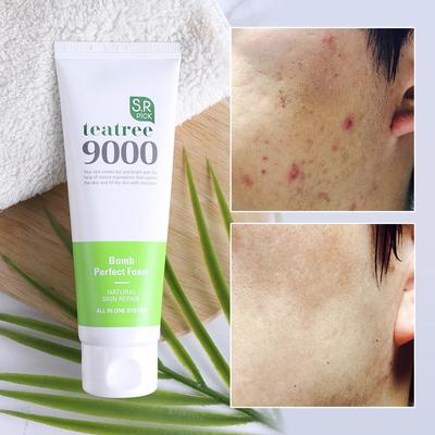 Trouble Marks, Dead Skin Cells, Pore Shrinking Tea Tree Bomb Foam Cleansing 120ml, 1 Piece