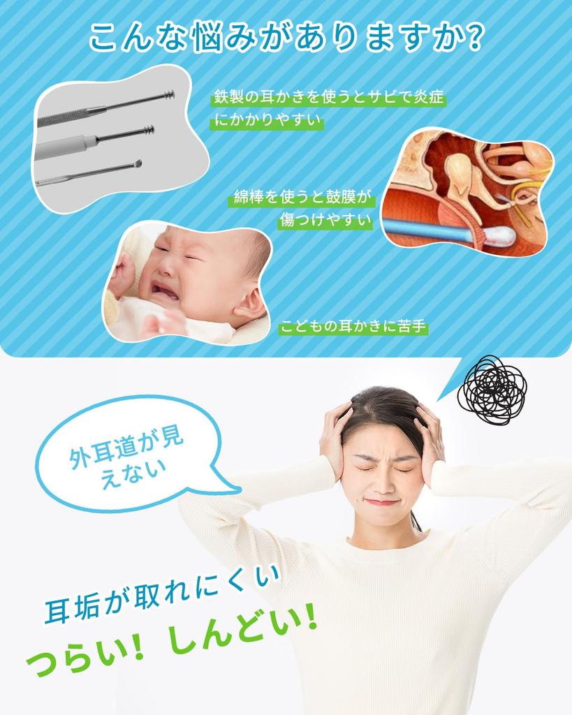Wireless Ear Cleaning Camera with 5MP High Resolution Youmay Ear Cleaning Inversion Video Photo WIFI IP67 Ear Cleaning Ear Cleaning Earwax Cleaning