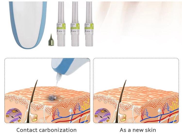 Rechargeable Magic Pen for Freckle & Mole Removal - Plasma Beauty Device with Magnetic Levitation