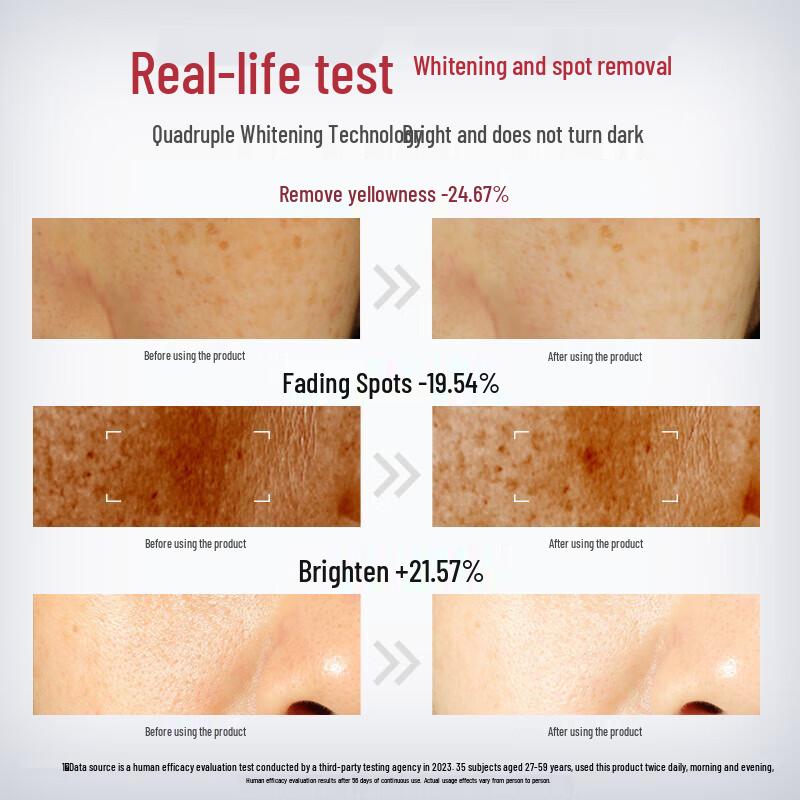 Dabao Vitamin C Niacinamide Whitening Spot-Fading Serum Lotion