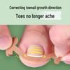Ortopedická náplast na korekci zarostlého nehtu bez lepidla pro Lala Manicure