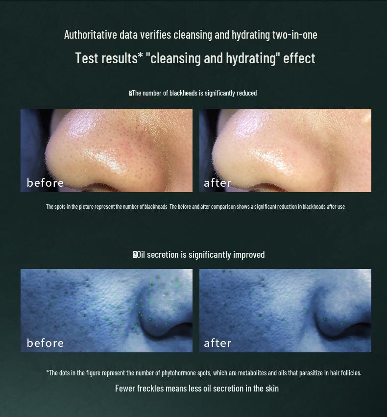 Micro-bubble Oxygen Injector Blackhead Remover: Home Pore Cleanser & Hydration Tool