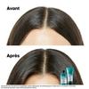 L#039;Oréal Professionnel Série Expert Șampon Scalp Advanced Recharge Anti-Disconfort 500ml