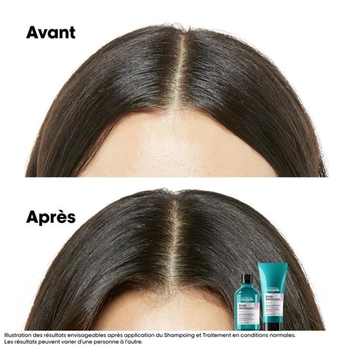 L#039;Oréal Professionnel Série Expert Șampon Scalp Advanced Recharge Anti-Disconfort 500ml