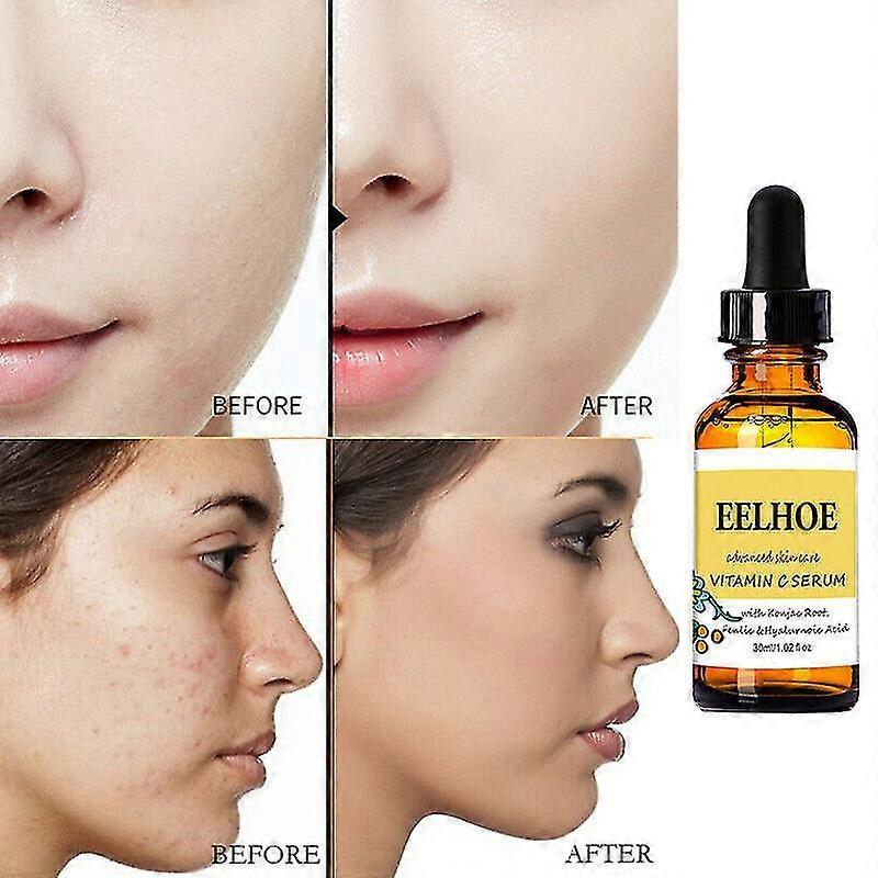 3Pcs Vitamin C Face Serum Cream Anti Ageing/aging Anti Wrinkle Moisturizing Cream