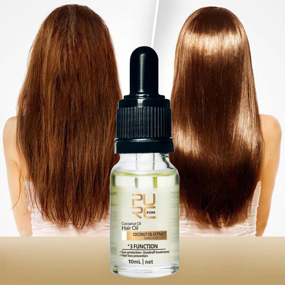 Anti Hair Loss Anti Dandruff Coconut Oil Care Essence 10ml Buy At