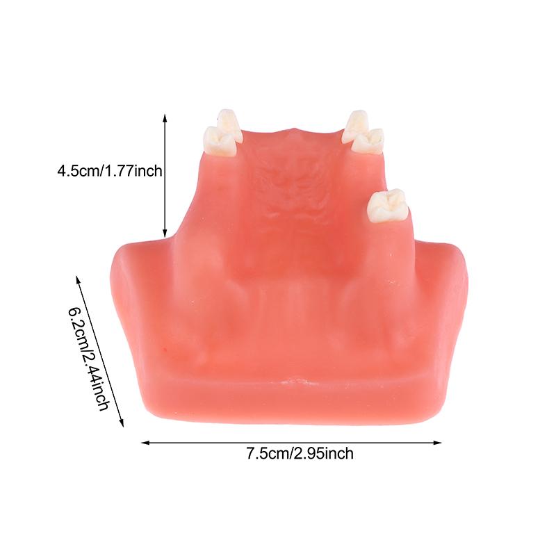 Maxillary Sinus Teeth Model Dental Implant Teaching Model For Dentist Student Practice Studying Oral Medical Model