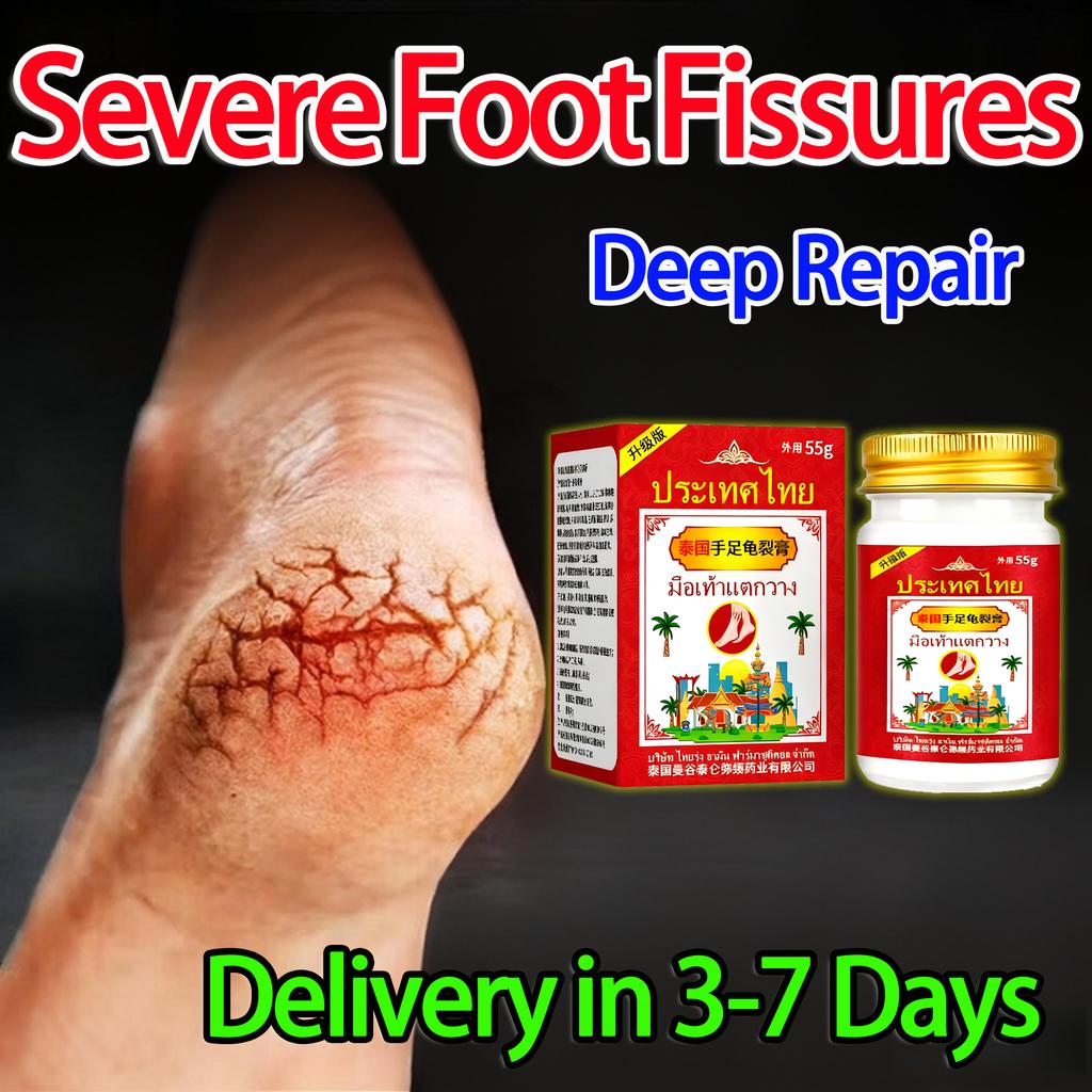 Balsam pentru Fisuri la Picioare - Special pentru Crăpături Rebele