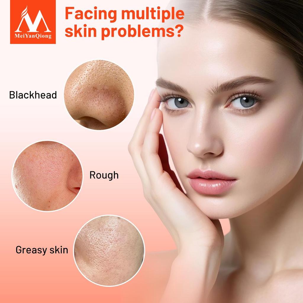 Volcanic Mud Black Mask Face Care Acne Blackhead Removal Treatment Whitening Moisturizing Skin Care Peel Mask Anti-Aging Cream