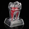 5 Stück Dental Anatomisches Modell Transparent Leuchtend Abnehmbar Einzelner Zahn Zerlegung Zahnmedizinische Klinik Ornamente
